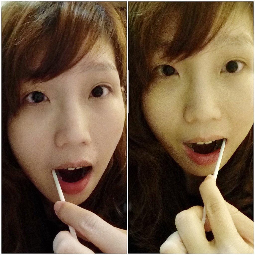 【GeNext健樂士】提早預防各種疾病,癌症會遺傳 / 大江基因 / 基因檢測平民化 - 第10張圖 【GeNext健樂士】提早預防各種疾病,癌症會遺傳 / 大江基因 / 基因檢測平民化