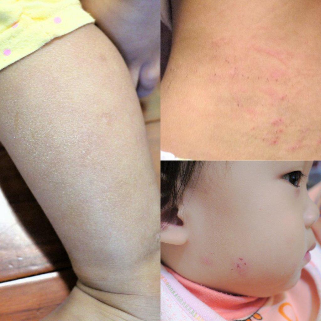 CEBELIA絲寶麗 寡胜肽瞬效修復霜,快速修復零負擔 / 減輕紅腫不適(文末專屬連結&優惠代碼) - 第8張圖 CEBELIA絲寶麗 寡胜肽瞬效修復霜,快速修復零負擔 / 減輕紅腫不適(文末專屬連結&優惠代碼)