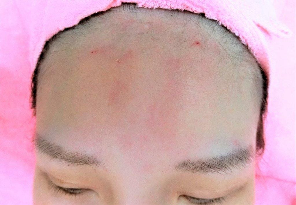 【保養】安佐雅美容美體會館 頂級臉部SPA護膚課程.增加肌膚鎖水 / 完美V型臉 - 第15張圖 【保養】安佐雅美容美體會館 頂級臉部SPA護膚課程.增加肌膚鎖水 / 完美V型臉