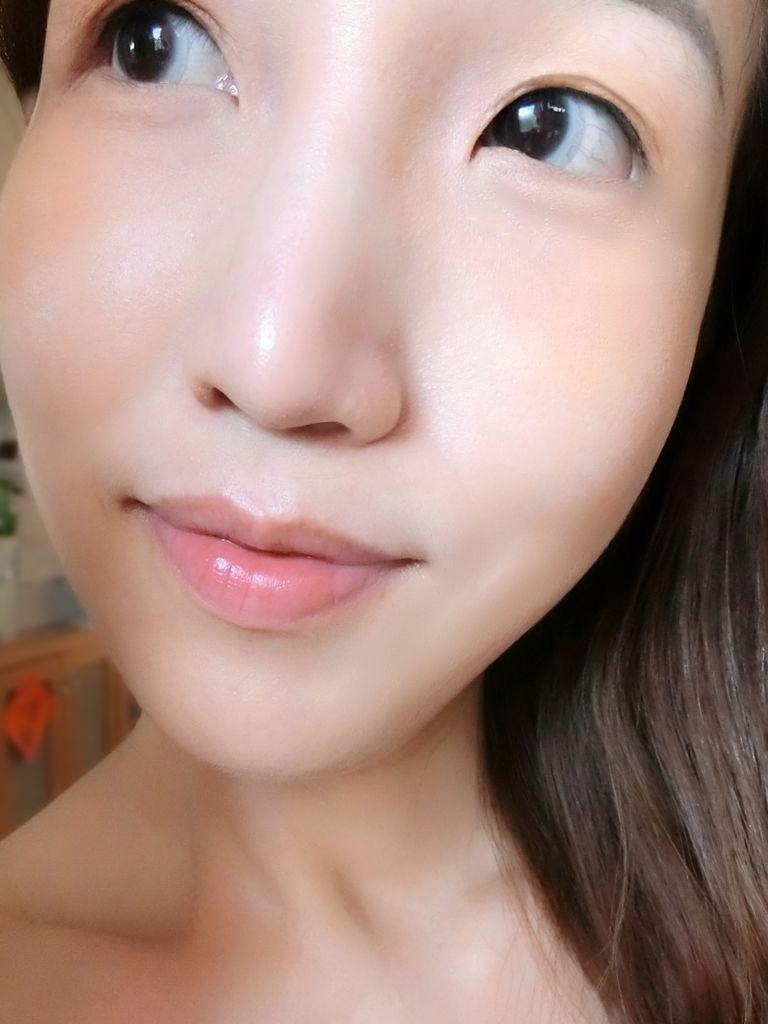 | 玻尿酸隆鼻+肉毒小臉 | 仁愛星和診所 / 東區醫美 / 許源津醫師 專業 .細心服務 玻尿酸+肉毒(打造臉部自然曲線) - 第31張圖 | 玻尿酸隆鼻+肉毒小臉 | 仁愛星和診所 / 東區醫美 / 許源津醫師 專業 .細心服務 玻尿酸+肉毒(打造臉部自然曲線)