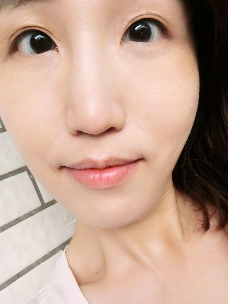 | 玻尿酸隆鼻+肉毒小臉 | 仁愛星和診所 / 東區醫美 / 許源津醫師 專業 .細心服務 玻尿酸+肉毒(打造臉部自然曲線) - 第30張圖 | 玻尿酸隆鼻+肉毒小臉 | 仁愛星和診所 / 東區醫美 / 許源津醫師 專業 .細心服務 玻尿酸+肉毒(打造臉部自然曲線)