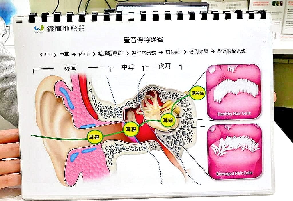 |板橋助聽器|維膜助聽器.精密聽力檢測.數位聚焦收音.最高補助7萬 - 第44張圖 |板橋助聽器|維膜助聽器.精密聽力檢測.數位聚焦收音.最高補助7萬