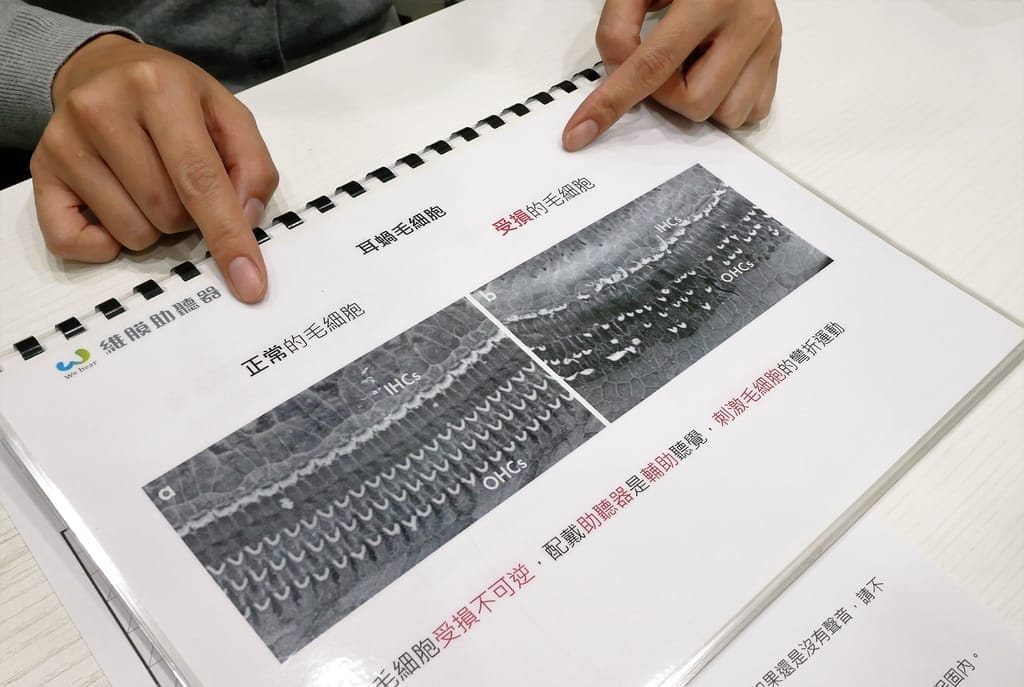|板橋助聽器|維膜助聽器.精密聽力檢測.數位聚焦收音.最高補助7萬 - 第45張圖 |板橋助聽器|維膜助聽器.精密聽力檢測.數位聚焦收音.最高補助7萬