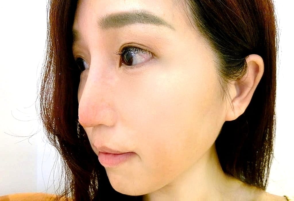 | 醫美 | 京站好萊塢診所.提.美.拉埋線.不動刀立體鼻雕推薦.快速擁有自然美鼻,陳柏森醫生 - 第25張圖 | 醫美 | 京站好萊塢診所.提.美.拉埋線.不動刀立體鼻雕推薦.快速擁有自然美鼻,陳柏森醫生