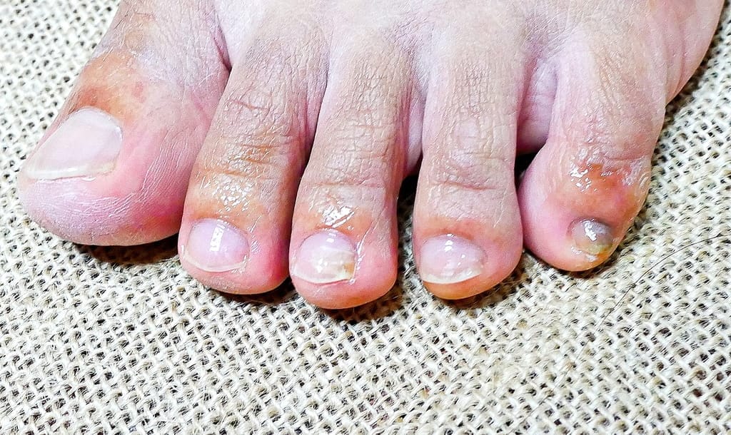 | 指甲保養|TRIND 適樂甲修護液.溫和抗菌/增加保養度.指甲與手部護理.改善指甲的脆弱 - 第24張圖 | 指甲保養|TRIND 適樂甲修護液.溫和抗菌/增加保養度.指甲與手部護理.改善指甲的脆弱