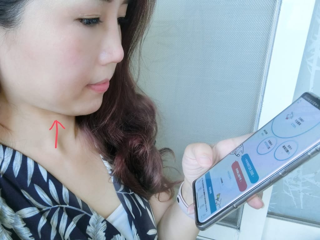|台北醫美診所推薦|琢美妍時尚診所.LV立特拉音波.林君曄醫師專業有耐心,音波拉提心得分享~ - 第2張圖 |台北醫美診所推薦|琢美妍時尚診所.LV立特拉音波.林君曄醫師專業有耐心,音波拉提心得分享~