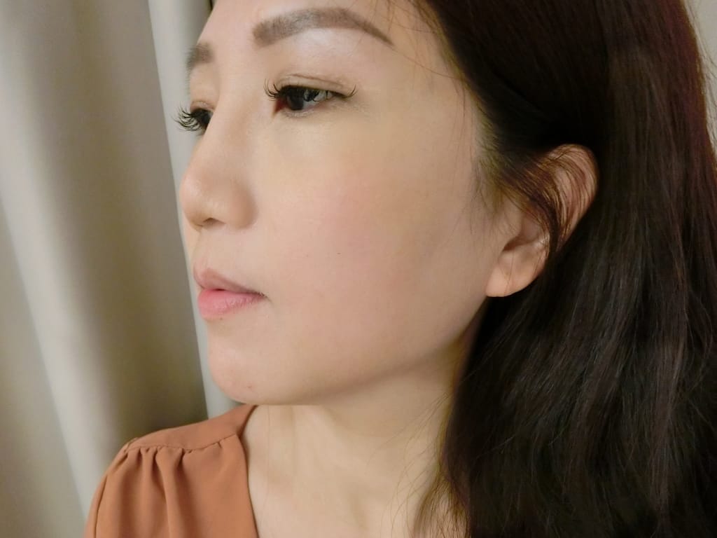 |台北醫美診所推薦|琢美妍時尚診所.LV立特拉音波.林君曄醫師專業有耐心,音波拉提心得分享~ - 第30張圖 |台北醫美診所推薦|琢美妍時尚診所.LV立特拉音波.林君曄醫師專業有耐心,音波拉提心得分享~