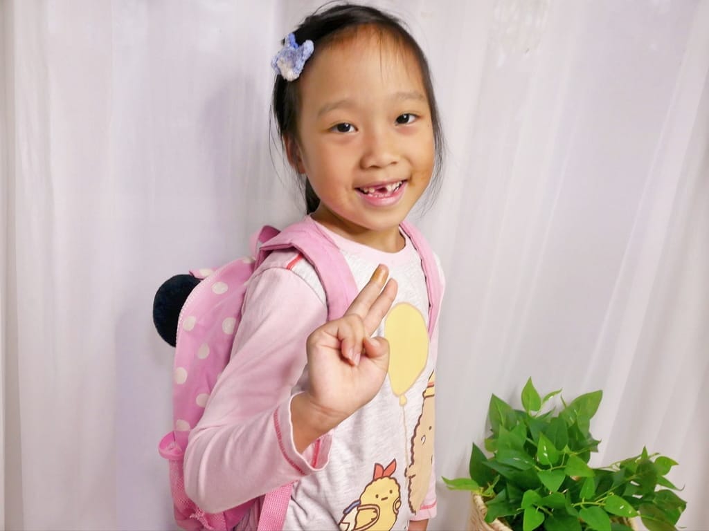 小孩受傷換藥不喊痛!生活居家常備品-康威多愛膚人工皮搭配康威愛康膚銀抗菌敷料,完整呵護傷口 - 第36張圖 小孩受傷換藥不喊痛!生活居家常備品-康威多愛膚人工皮搭配康威愛康膚銀抗菌敷料,完整呵護傷口