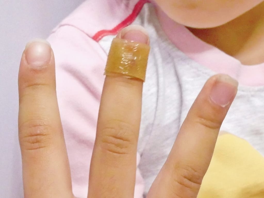 小孩受傷換藥不喊痛!生活居家常備品-康威多愛膚人工皮搭配康威愛康膚銀抗菌敷料,完整呵護傷口 - 第27張圖 小孩受傷換藥不喊痛!生活居家常備品-康威多愛膚人工皮搭配康威愛康膚銀抗菌敷料,完整呵護傷口