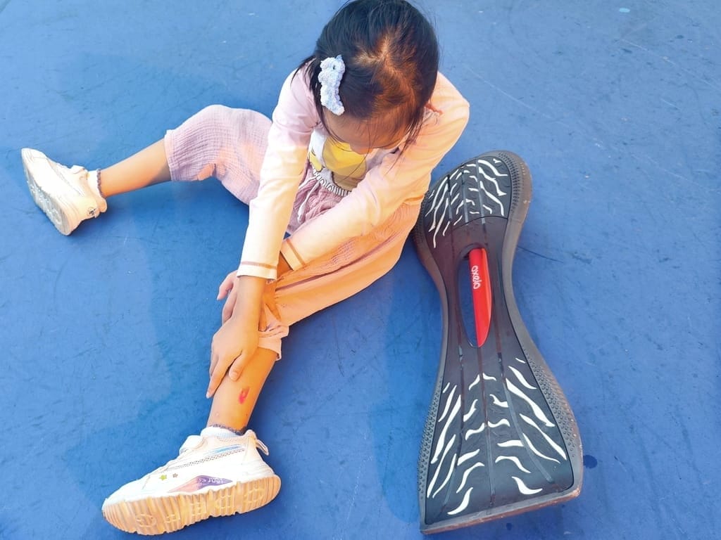 小孩受傷換藥不喊痛!生活居家常備品-康威多愛膚人工皮搭配康威愛康膚銀抗菌敷料,完整呵護傷口 - 第38張圖 小孩受傷換藥不喊痛!生活居家常備品-康威多愛膚人工皮搭配康威愛康膚銀抗菌敷料,完整呵護傷口