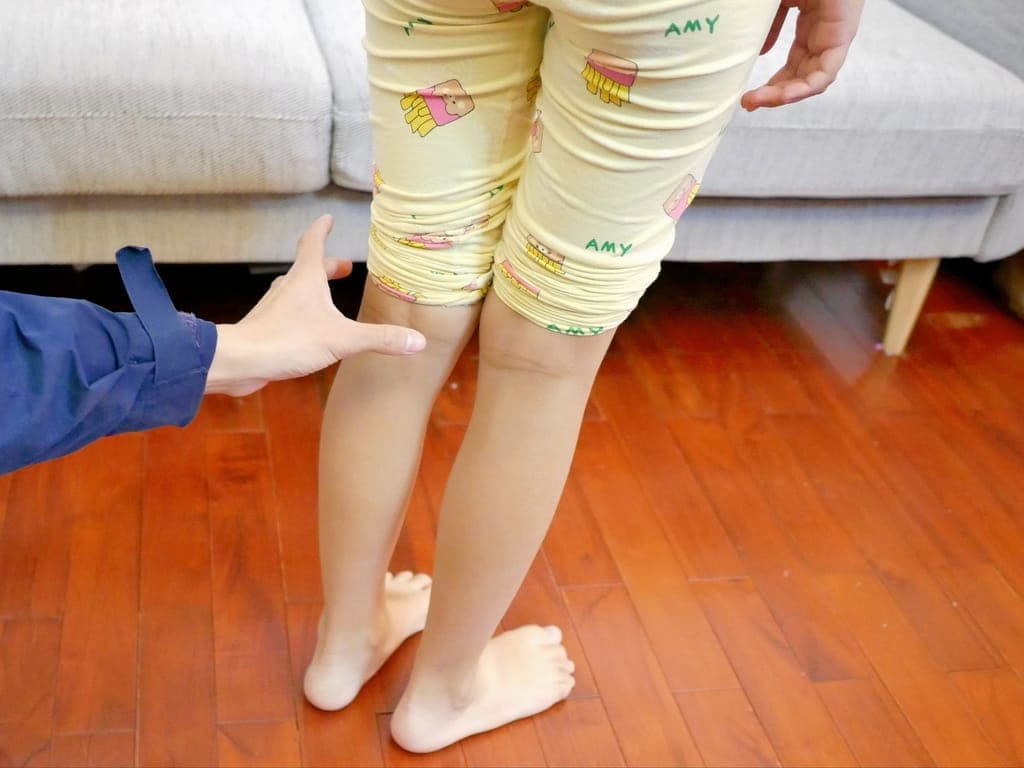 | 兒童鞋墊 | 走四方客製鞋墊中心.到宅服務,兒童3D取模,物理治療師親自評估! - 第17張圖 | 兒童鞋墊 | 走四方客製鞋墊中心.到宅服務,兒童3D取模,物理治療師親自評估!