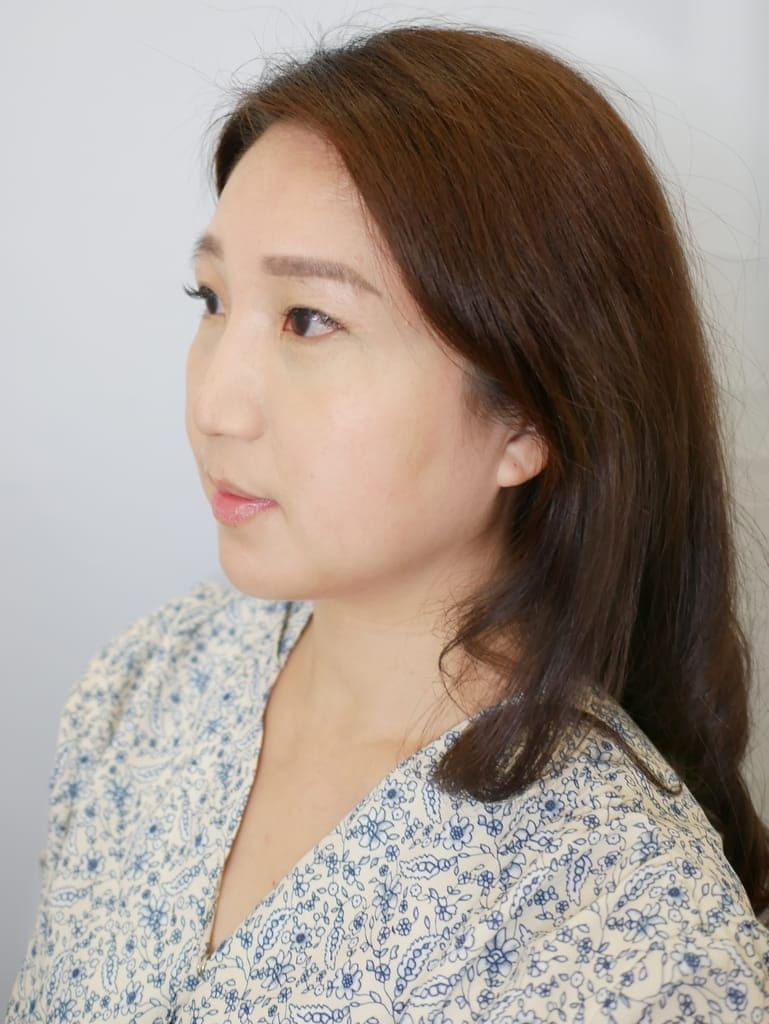 |醫美診所推薦|台北東妍醫美.消脂容脂針注射,打造完美鵝蛋臉.和雙下巴說掰掰~玉媽咪心得分享! - 第16張圖 |醫美診所推薦|台北東妍醫美.消脂容脂針注射,打造完美鵝蛋臉.和雙下巴說掰掰~玉媽咪心得分享!