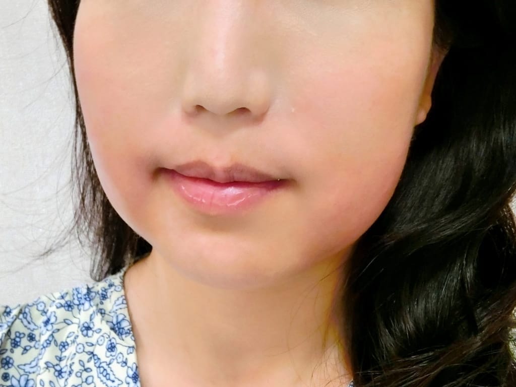 |醫美診所推薦|台北東妍醫美.消脂容脂針注射,打造完美鵝蛋臉.和雙下巴說掰掰~玉媽咪心得分享! - 第26張圖 |醫美診所推薦|台北東妍醫美.消脂容脂針注射,打造完美鵝蛋臉.和雙下巴說掰掰~玉媽咪心得分享!