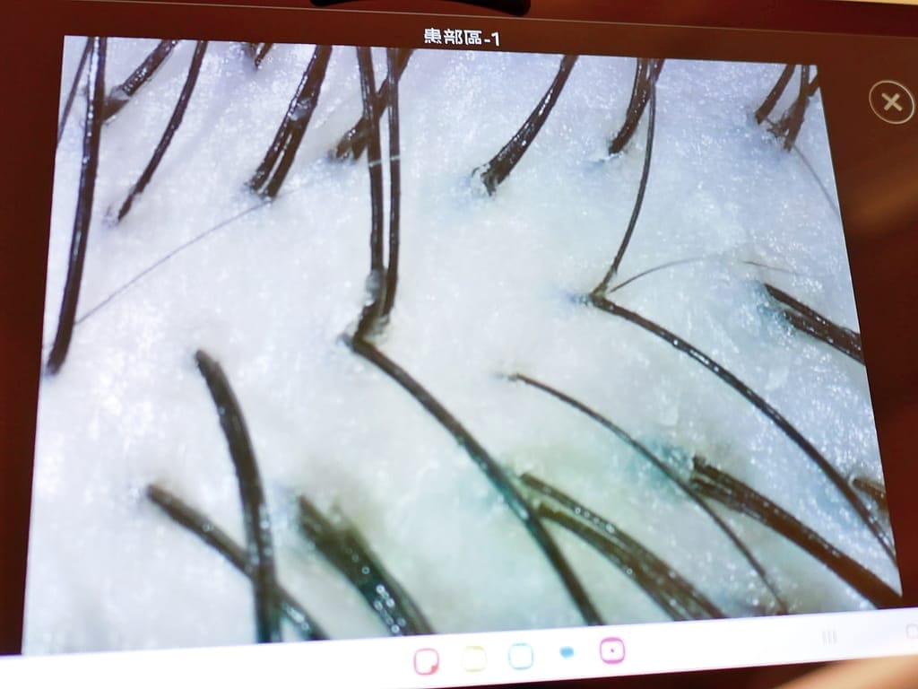 |台北頭皮SPA|EDNA頭皮蘊養中心.微生態淨化修護體驗.搶救頭皮危機.準確檢測頭皮健康狀況! - 第24張圖 |台北頭皮SPA|EDNA頭皮蘊養中心.微生態淨化修護體驗.搶救頭皮危機.準確檢測頭皮健康狀況!