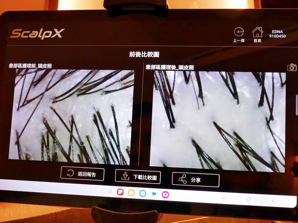 |台北頭皮SPA|EDNA頭皮蘊養中心.微生態淨化修護體驗.搶救頭皮危機.準確檢測頭皮健康狀況! - 第48張圖 |台北頭皮SPA|EDNA頭皮蘊養中心.微生態淨化修護體驗.搶救頭皮危機.準確檢測頭皮健康狀況!