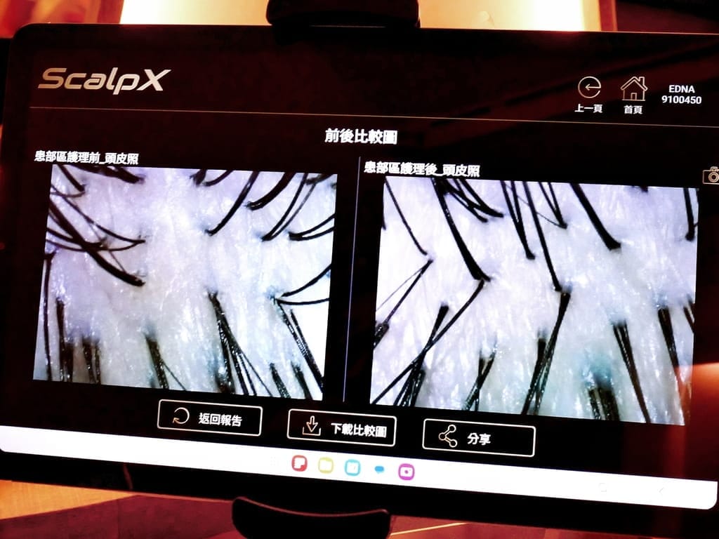 |台北頭皮SPA|EDNA頭皮蘊養中心.微生態淨化修護體驗.搶救頭皮危機.準確檢測頭皮健康狀況! - 第49張圖 |台北頭皮SPA|EDNA頭皮蘊養中心.微生態淨化修護體驗.搶救頭皮危機.準確檢測頭皮健康狀況!